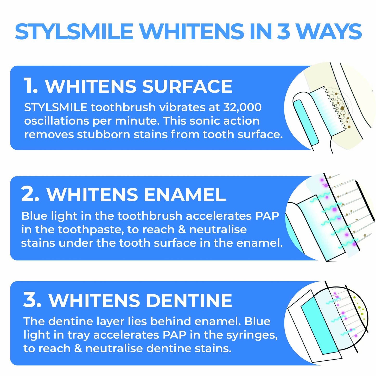 STYLSMILE Ultimate Whitening Kit